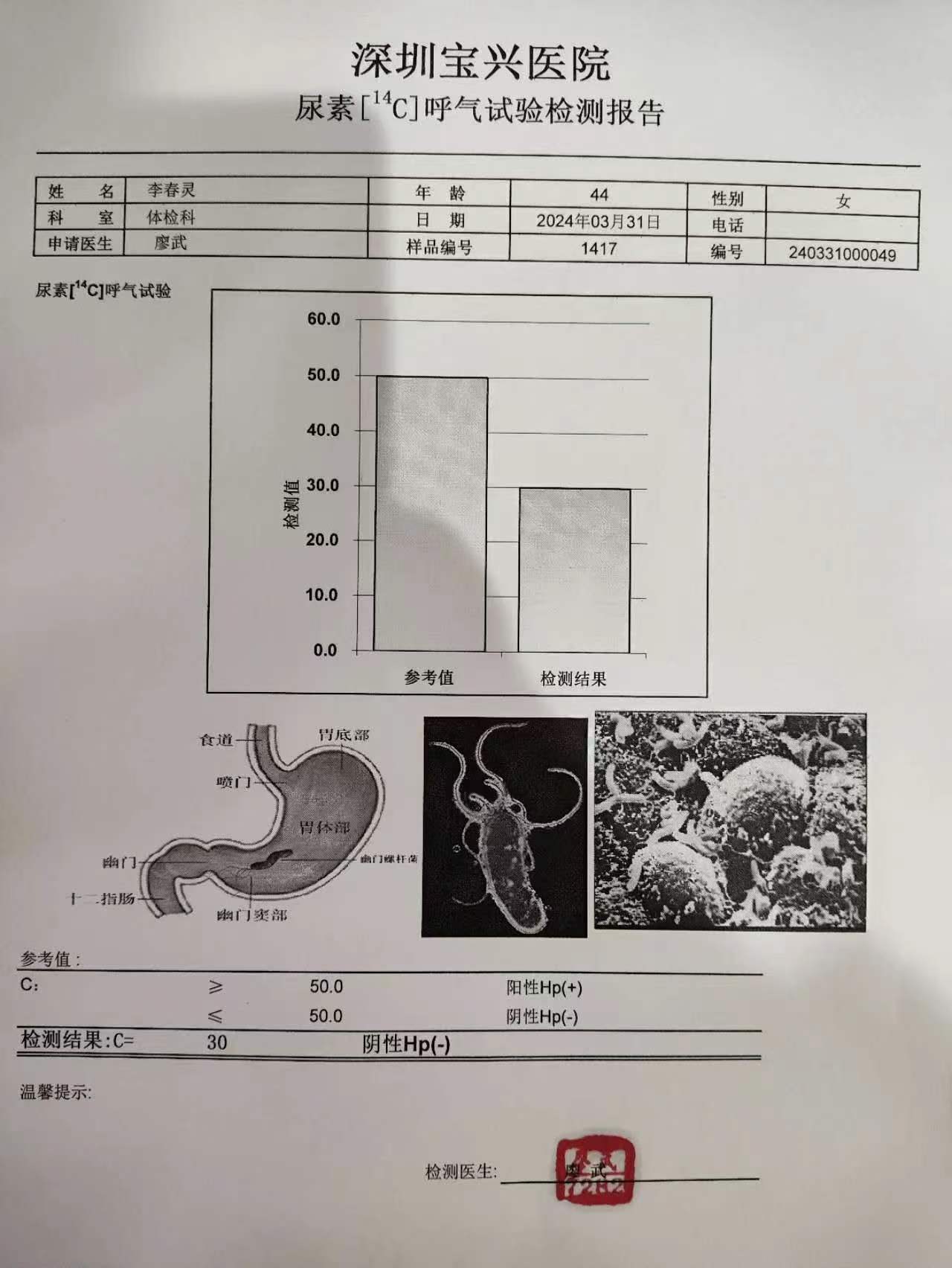 獲得術(shù)前三項